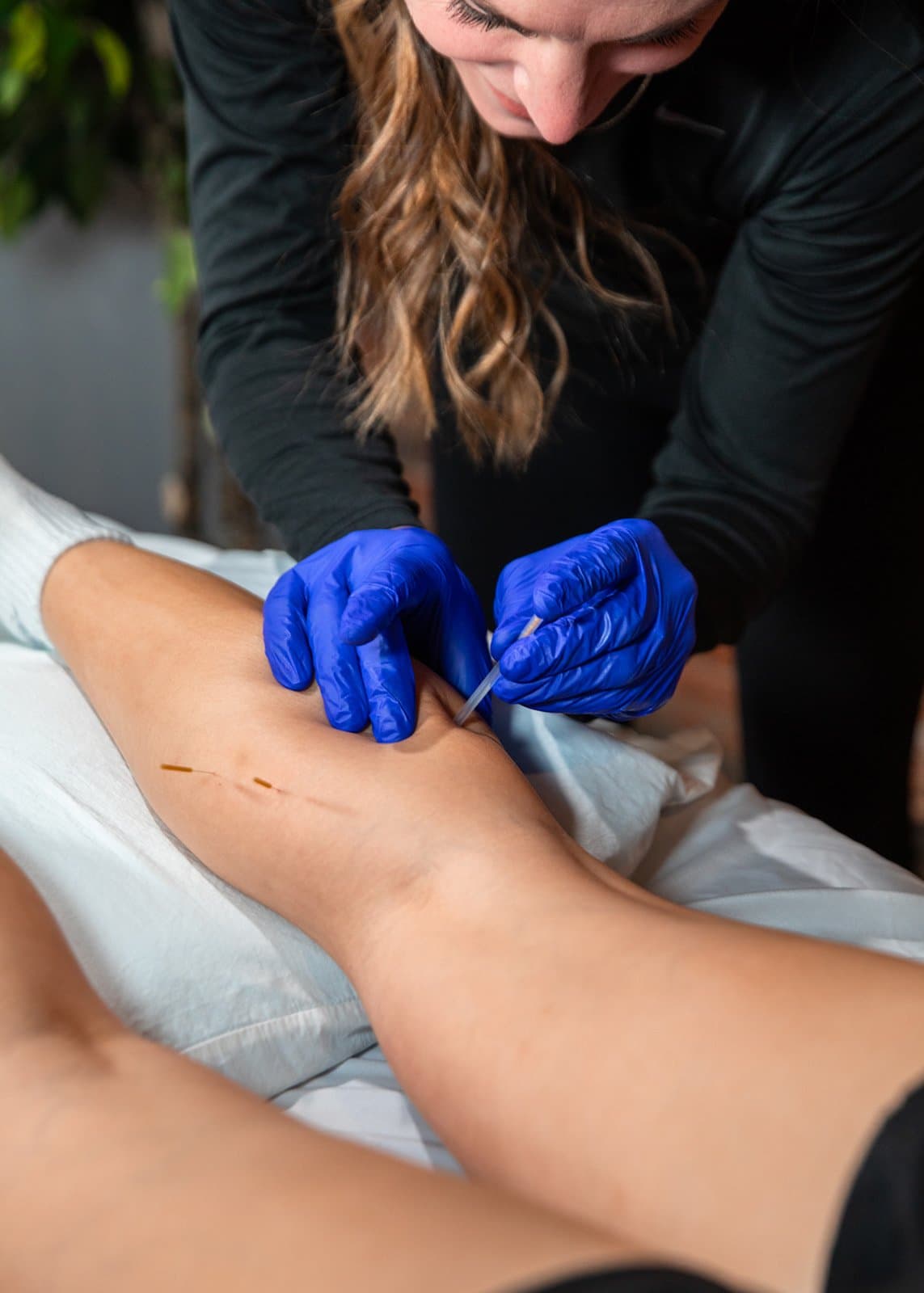 Dr. Molly performing Integrative Dry Needling