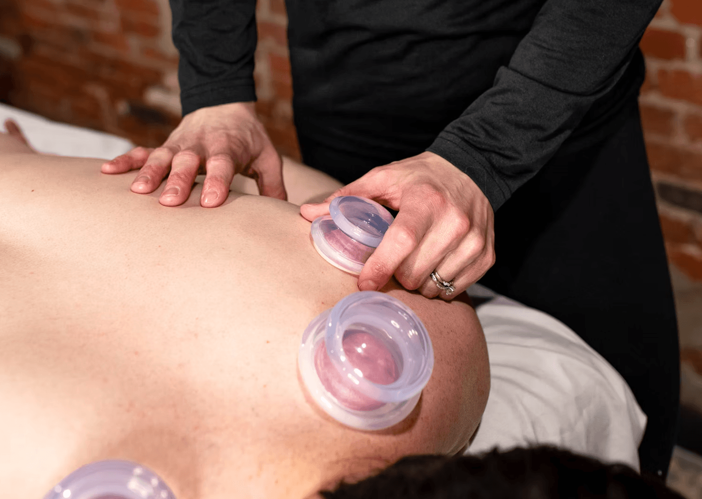 Dr. Molly performing Cupping